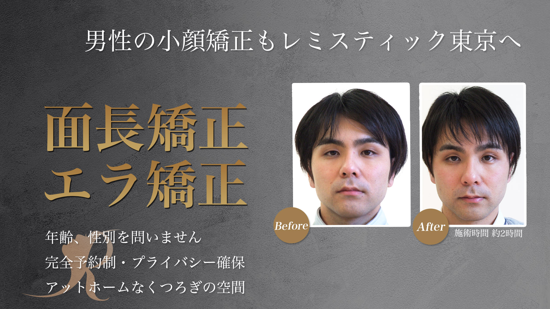 登録商標 小顔矯正 エラ 面長 ハチ張り改善 レミスティック東京 港区